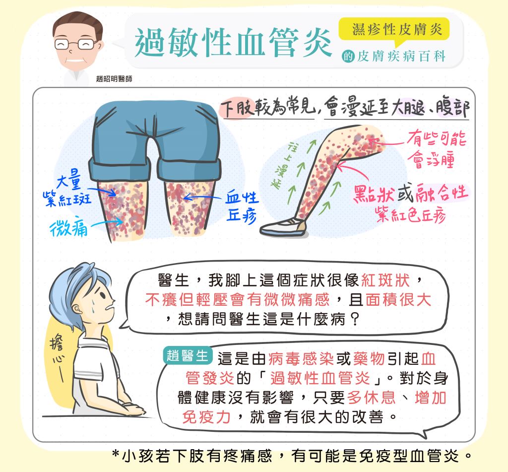 過敏性血管炎Allergic vasculitis